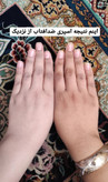 اسپری سفیدکننده بیواکوا
